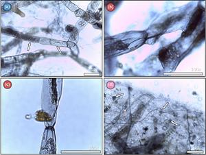 Microscopic moss analysis