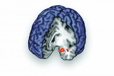 Social Rejection Brain Image