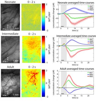 Development of the Hemodynamic Response