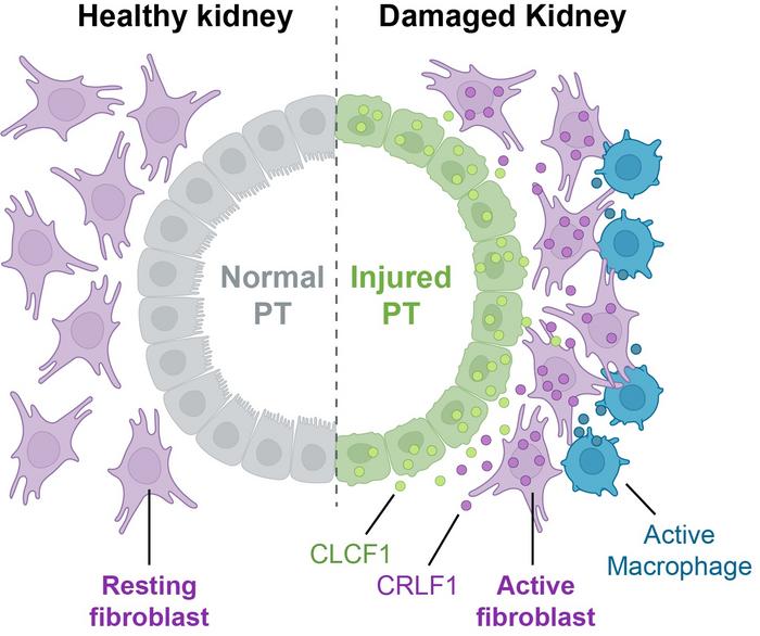 Healthy vs. Damaged Kidney