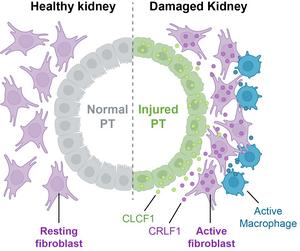 Healthy vs. Damaged Kidney