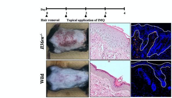 Microscopic observations of psoriasis