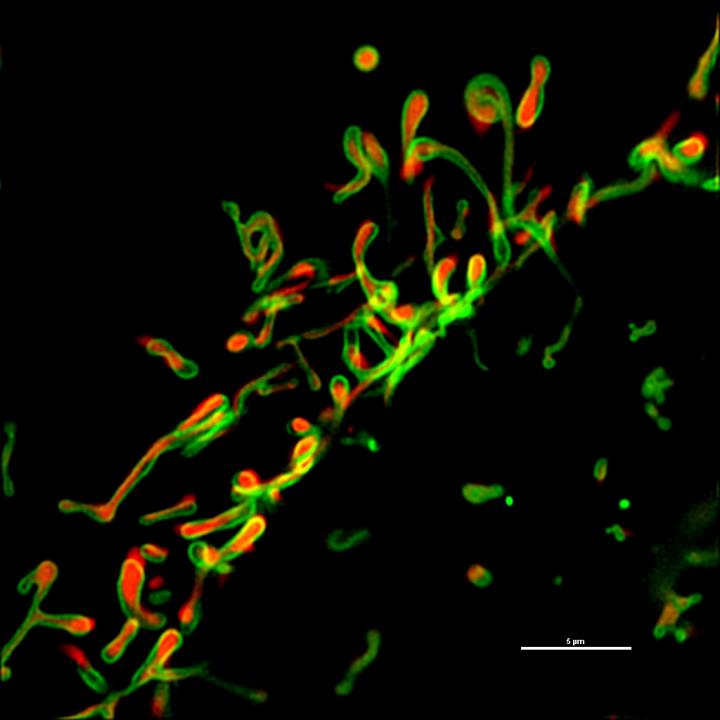 Miro2 Is a Parkin Receptor for Selective Removal of Damaged Mitochondria
