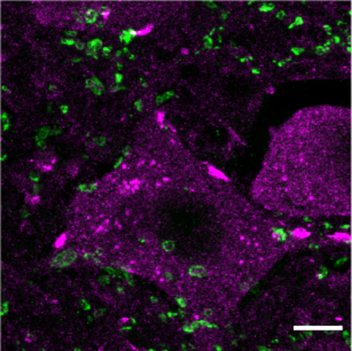 Epigenetic treatment in mice improves spinal cord regeneration after injury