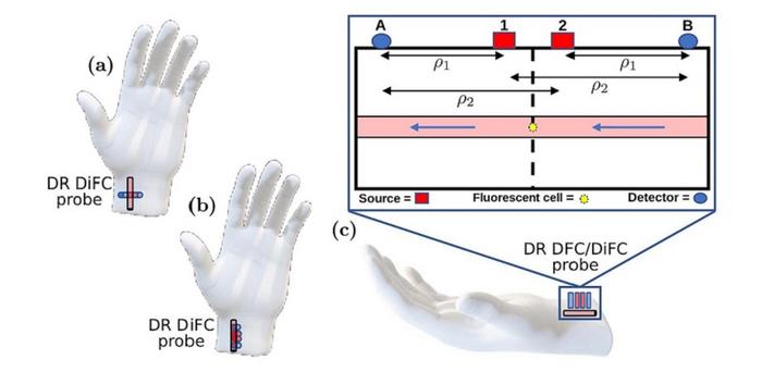 The dual-ratio (DR) diffuse in-vivo flow cytometry (DiFC) is a novel technique that uses two laser sources and two detectors to mitigate the effects of noise and autofluorescence, which may enable doctors to precisely detect fluorescent tags attached to c