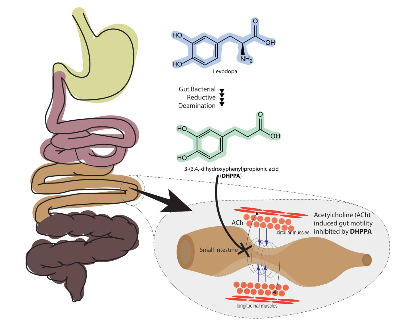 Levodopa conversion by gut bacteria