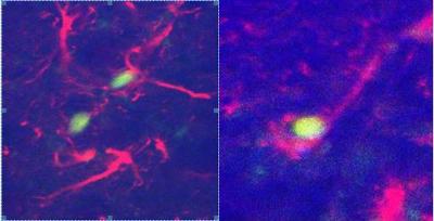 Reversing Brain Defects