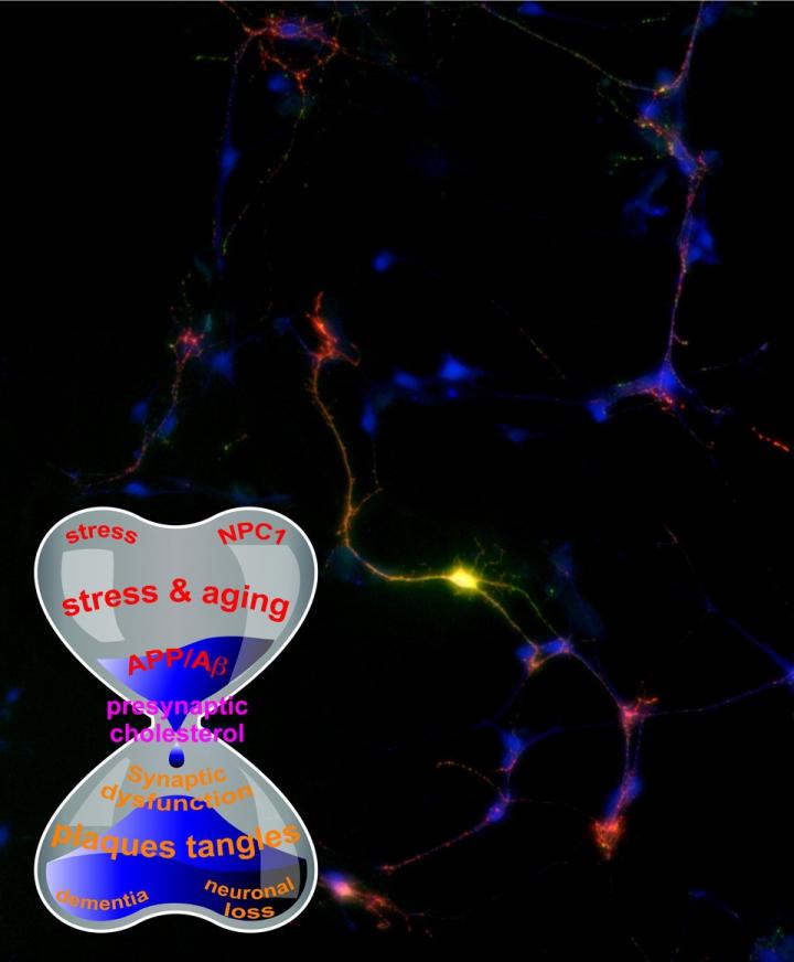 New Theory on Alzheimer's, Amyloid Connection