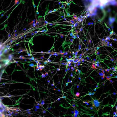 Williams Syndrome-Derived Neurons in Culture