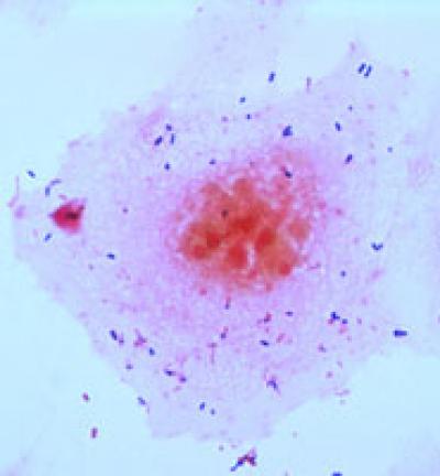 Streptococcus Bacteria (1 of 2)