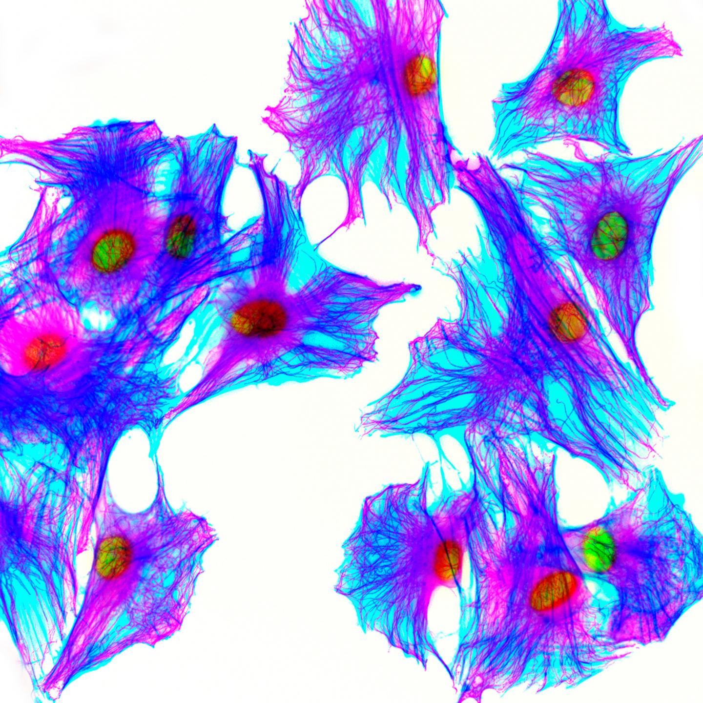 Low Doses of Radiation Used in Medical Imaging Lead to Mutations in Cell Cultures