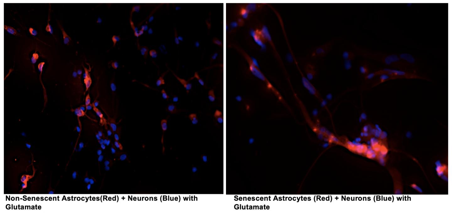 Non-Senescent and Senescent Astrocytes