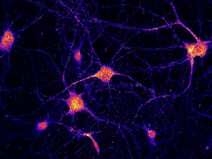 Localization of the FERRY complex in neurons.