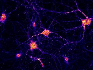 Localization of the FERRY complex in neurons.