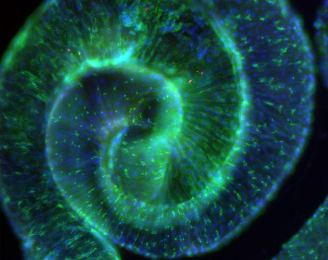 Gut Bacterium Indirectly Causes Symptoms by Altering Fruit Fly Microbiome