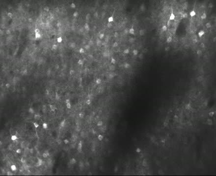 Neurons in the Mouse Retrosplenial Cortex