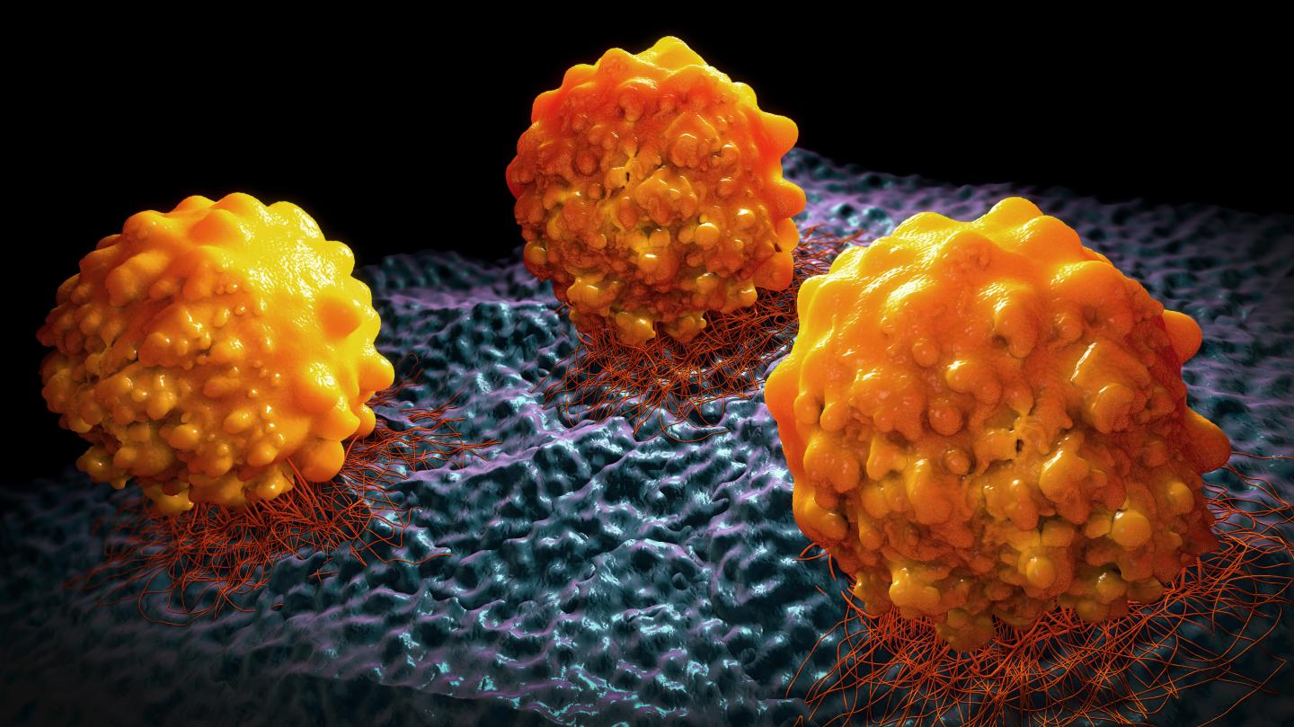 Preventing Metastasis by Stopping Cancer Cells from Making Fat (1 of 2)