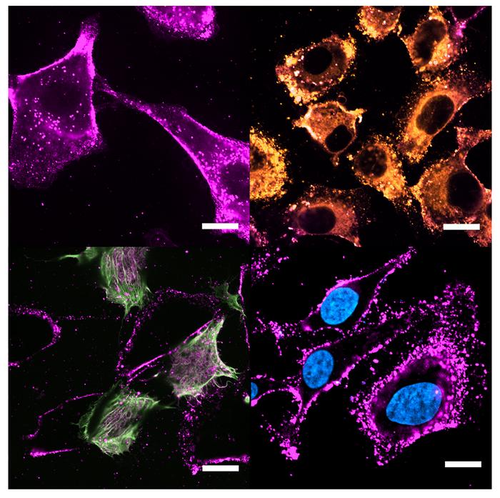 Cell-derived nanocarriers for more efficient and direct intracelular drug release