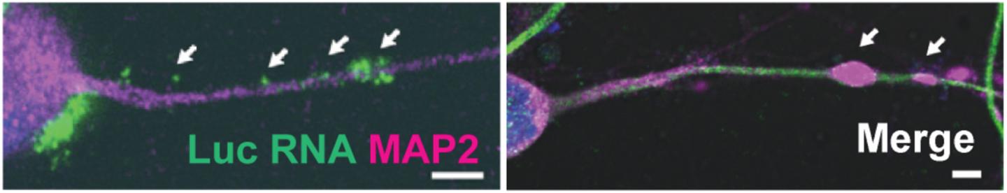 Viral RNA Being Transported to Dendrite