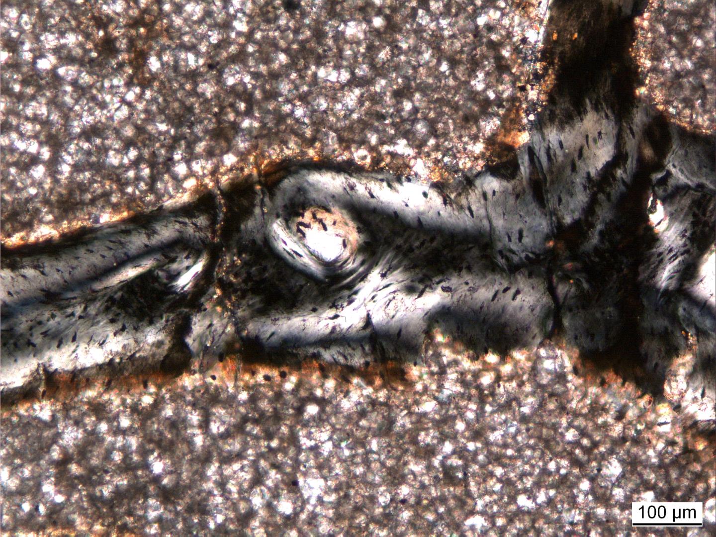 A Bone Trabecle of This Vertebral Cavity