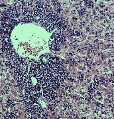 Infection with a Strain of Yellow Fever Virus YFD-17D) in Mouse Liver