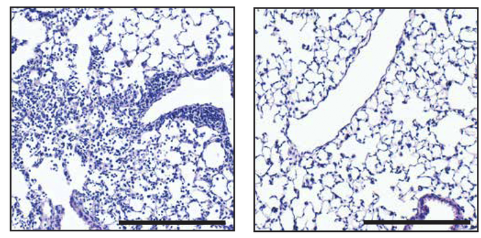 : SLR14 reduces pneumonia in SARS-CoV-2¬–infected mice