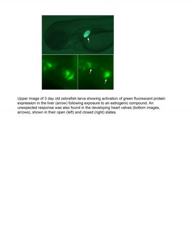 Environmental Endocrine Disrupters and Heart Valves