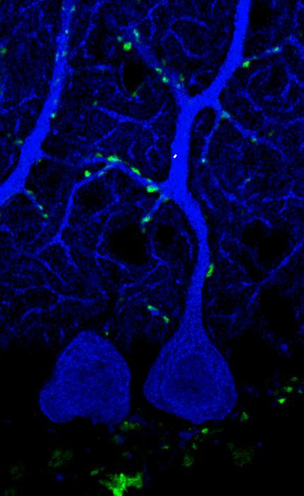 Synaptic boutons of climbing fibers on a Purkinje cell from the cerebellum of a mouse