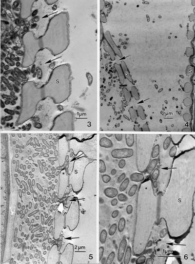 Microscopic Photography Reveals Bacteria Destroying Cell Wall in Wine Grape Vines (1 of 2)