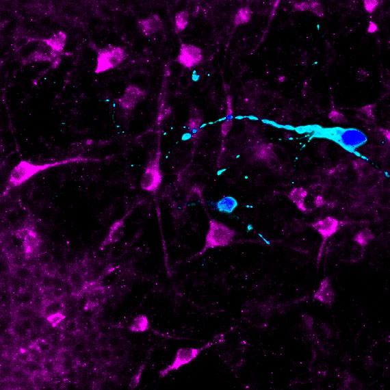 Two Types of iPSC-Derived Hypothalamic Neurons (2 of 2)