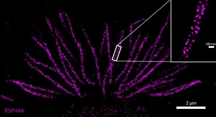 High-Resolution Imaging Toolbox Scopes Out Genetic Lung Disorder Using Hairy Cells (3 of 3)