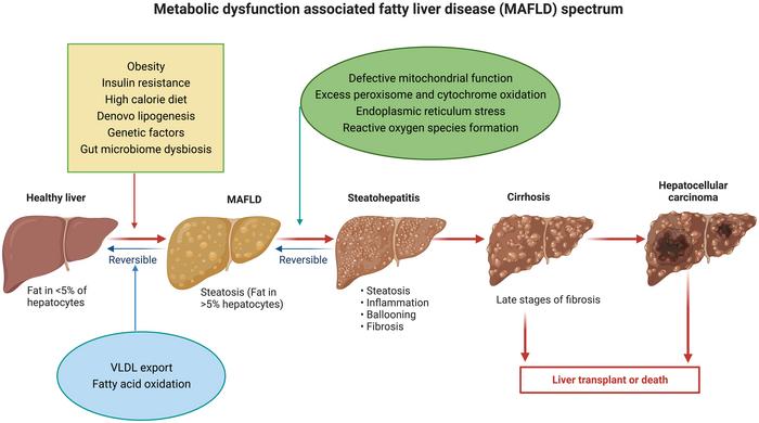 Pathogenesis and spectrum of MAFLD