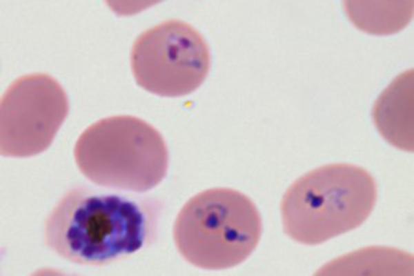 Researchers Map Malaria Parasites Proliferate in Human Blood Cells