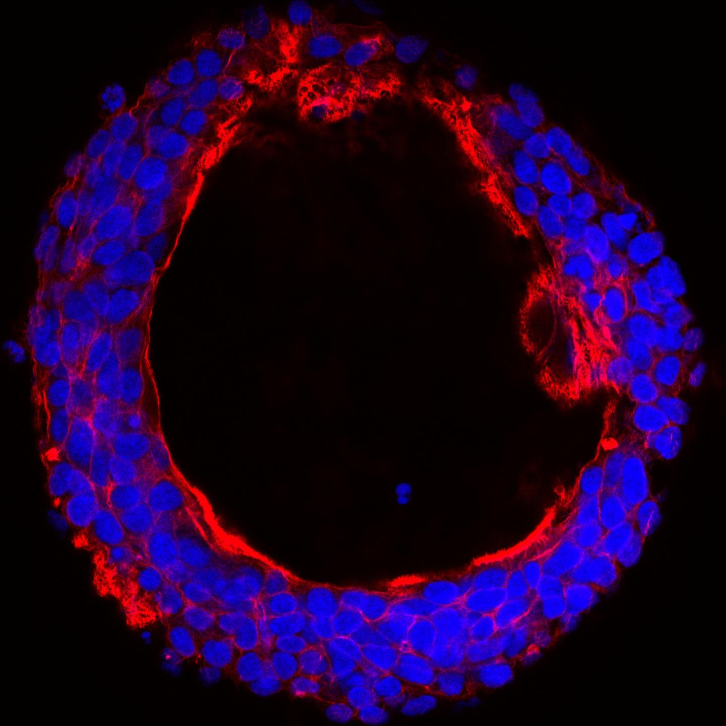 Selective Upregulation of O-Glycosylation in Colon Cancer Cells
