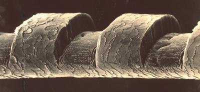 Micrograph of a Human Hair