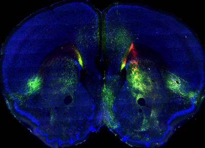 iConnectome Brain Image (1 of 2)