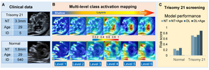 Visualization of the response region to show class-specific information for multilevel features