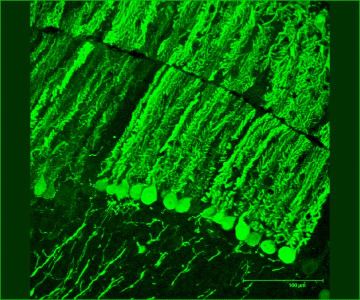 microRNA Therapy Protects Against Neurodegenerative Disorder (6 of 6)