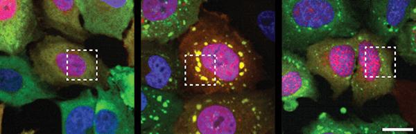 TDP-43, UC San Diego School of Medicine