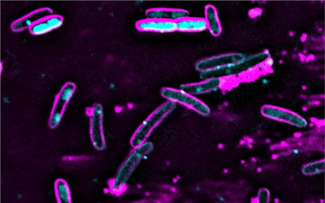 Emtpy Cells, Corbett, University of California San Diego