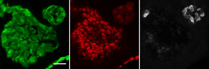 Mouse tumor organoids show features of early stage lung cancer