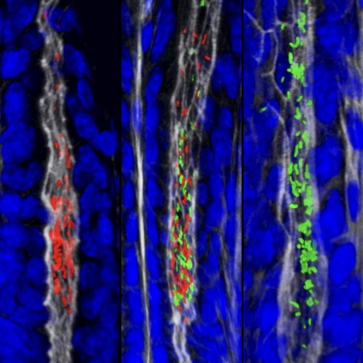 Pathogens Find Safe Harbor Deep in the Gastric Glands