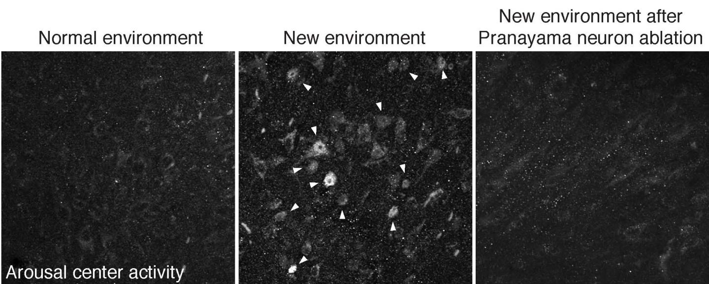 Uncovered: Neurons that Influence Stressed Versus Calmed States (2 of 3)