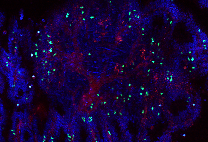 Mouse colorectal tumor