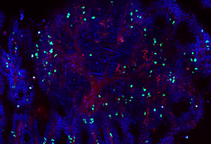 Mouse colorectal tumor