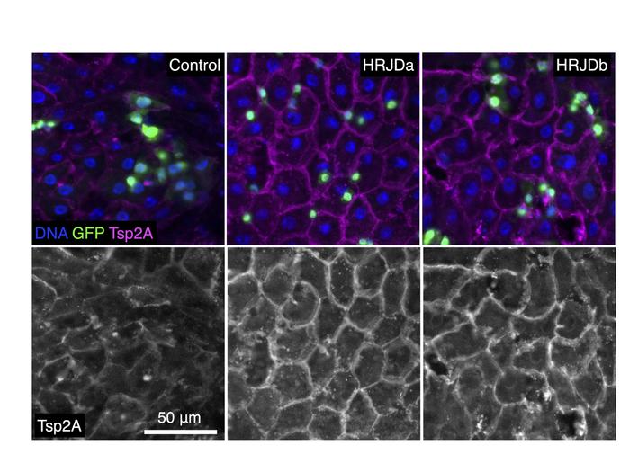 Suppressing gut barrier