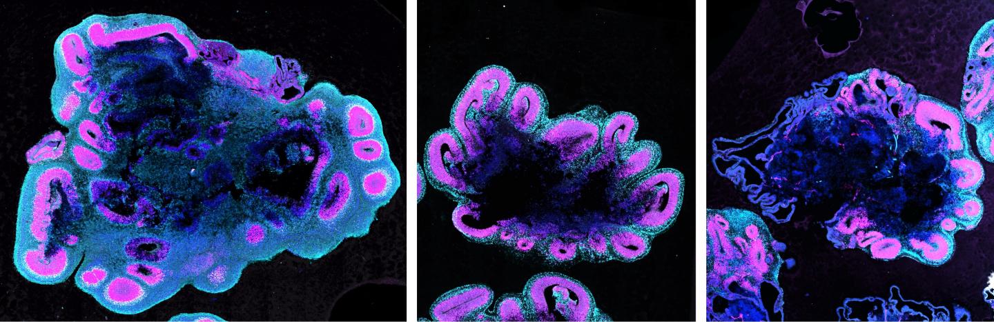 Human, gorilla and chimpanzee brain organoids