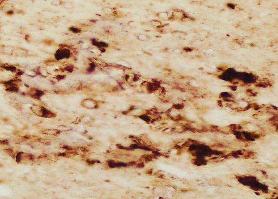 Brain of a Mouse Inoculated with Infectious Prions