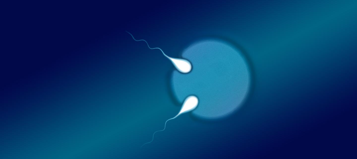 Two Sperm Fertilizing An Egg