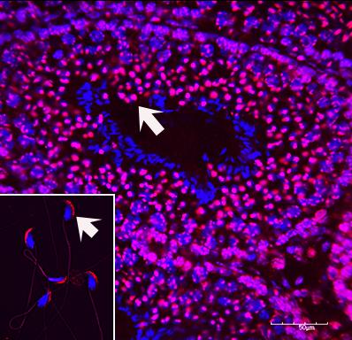 Father's Nicotine Use Can Cause Cognitive Problems in Children and Grandchildren